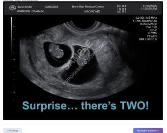 Create Custom Scan-Style Images• Personalized Baby Sonogram Art • Pregnancy Reveal Digital Download