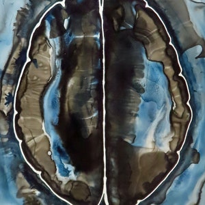 Tapestry of Memory original ink painting on yupo neuroscience art image 1