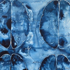 Lost in Dreams: Original ink painting on yupo of brain neuroscience art literature Dostoevsky image 3