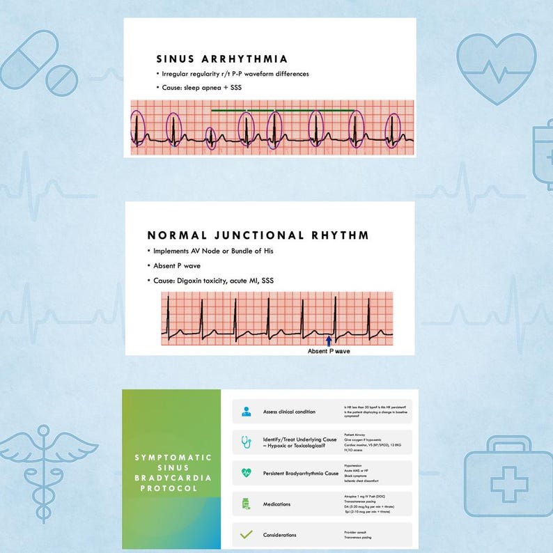 Printable ACLS & EKG Rhythm Study Guide PDF – Nursing Student ...
