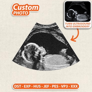 Peut inclure: Image brodée d'une échographie de bébé, avec le texte "Custom PHOTO" dans une bulle orange. L'image est une échographie en noir et blanc d'un fœtus. Le texte "TURN ULTRASOUND INTO EMBROIDERY" est également présent.