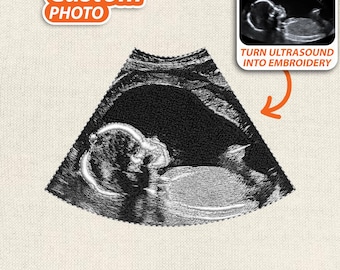 Custom Ultrasound Photo Embroidery Design, Personalized Baby Announcement Machine Stitch File, Nursery Sonogram Pattern