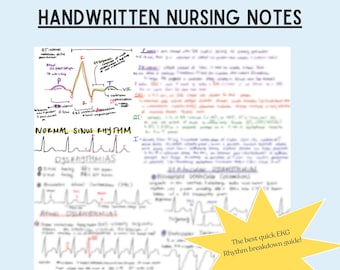 Cheatsheet voor ECG-ritme: naslagwerk voor visuele verpleegkundigen (pdf-download)
