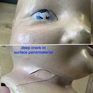 May include: Close-up of a vintage doll's head with visible signs of age. The porcelain surface shows all-over crazing and a deep crack. The doll's eye has missing paint. The text on the image reads: "all-over crazing missing paint on eyes" and "deep crack in surface paint/material".