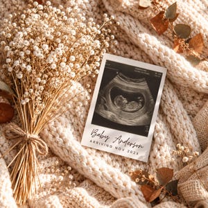 Puede incluir: Una impresión de ecografía rectangular que muestra una imagen fetal en blanco y negro con el texto Baby Anderson ARRIVING NOV 202X, junto a un ramo seco de flores blancas de paniculata atadas con un fino cordel de color marrón.