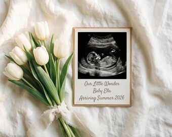 Minimal Baby Announcement Digital Template, Tulip Pregnancy Announcement, Editable Canva Baby Reveal, Instant Download, Social Media