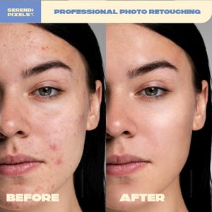 Può includere: Uno schermo diviso mostra un ritocco fotografico professionale. Il lato sinistro mostra un volto con texture della pelle visibile e imperfezioni, etichettato 'BEFORE'. Il lato destro mostra lo stesso volto con pelle levigata, etichettato 'AFTER'.