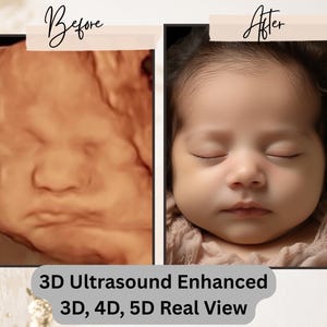 Turn Your Ultrasound into a Baby Picture. 3D, 4D, 5D and HD Ultrasound, Real View, ultrasound photo, unborn baby, ultrasound scan,8k image