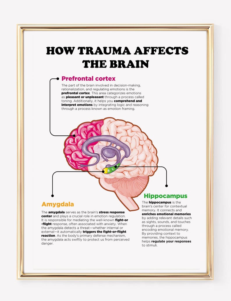 Trauma and the Brain Art Print, Mental Health Wall Art , Psychology Art ...