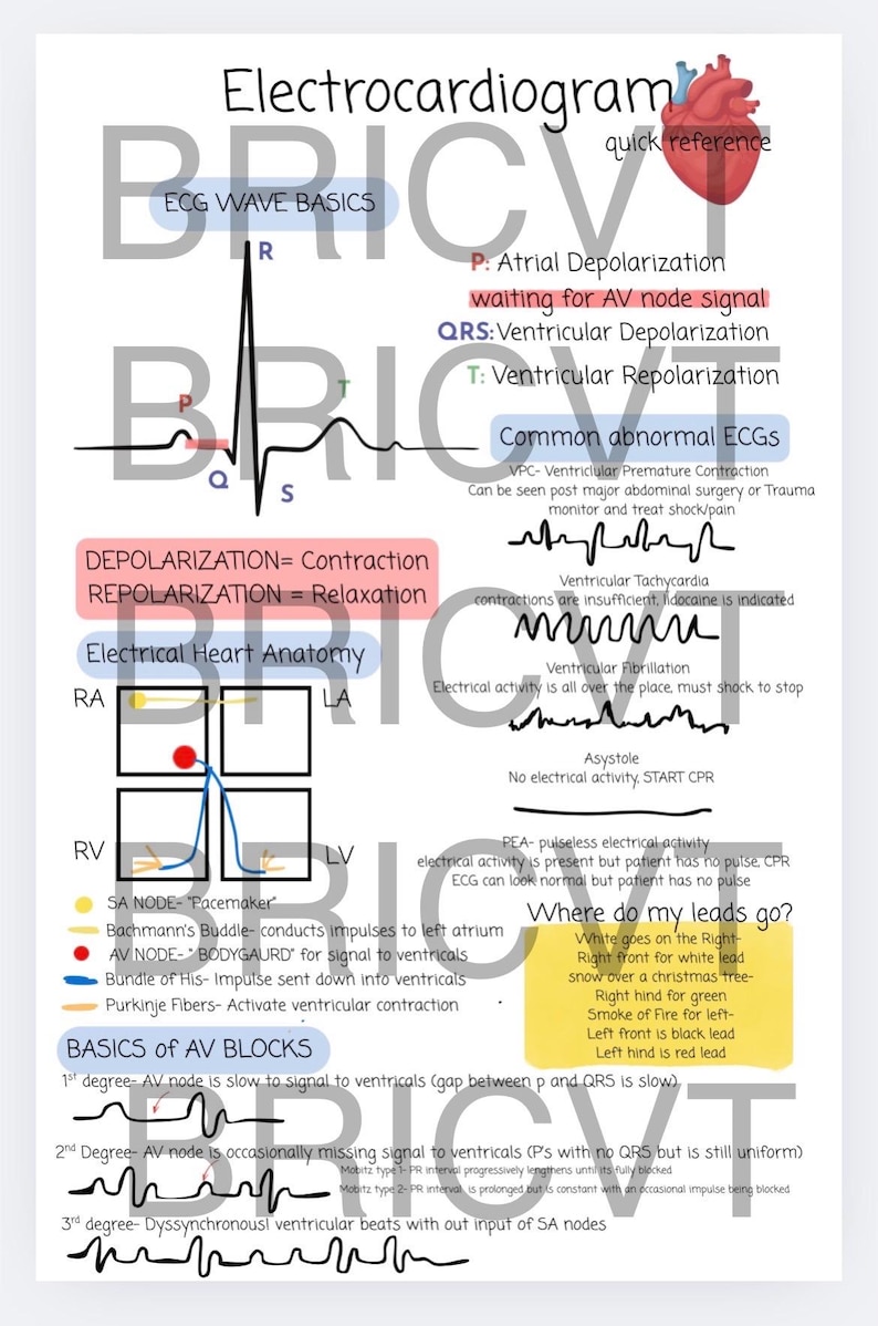 May include: An educational poster with the title "Electrocardiogram" features diagrams and text explaining ECG wave basics, heart anatomy, and common abnormalities. The poster includes a heart illustration and color-coded sections for easy understanding.