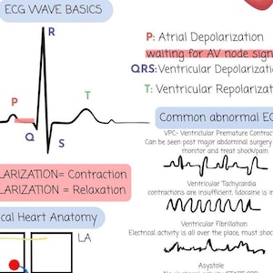 Può includere: Infografica educativa sugli elettrocardiogrammi (ECG). L'immagine presenta un diagramma delle onde ECG con etichette per le onde P, QRS e T, insieme a spiegazioni delle comuni anomalie ECG e dell'anatomia cardiaca.