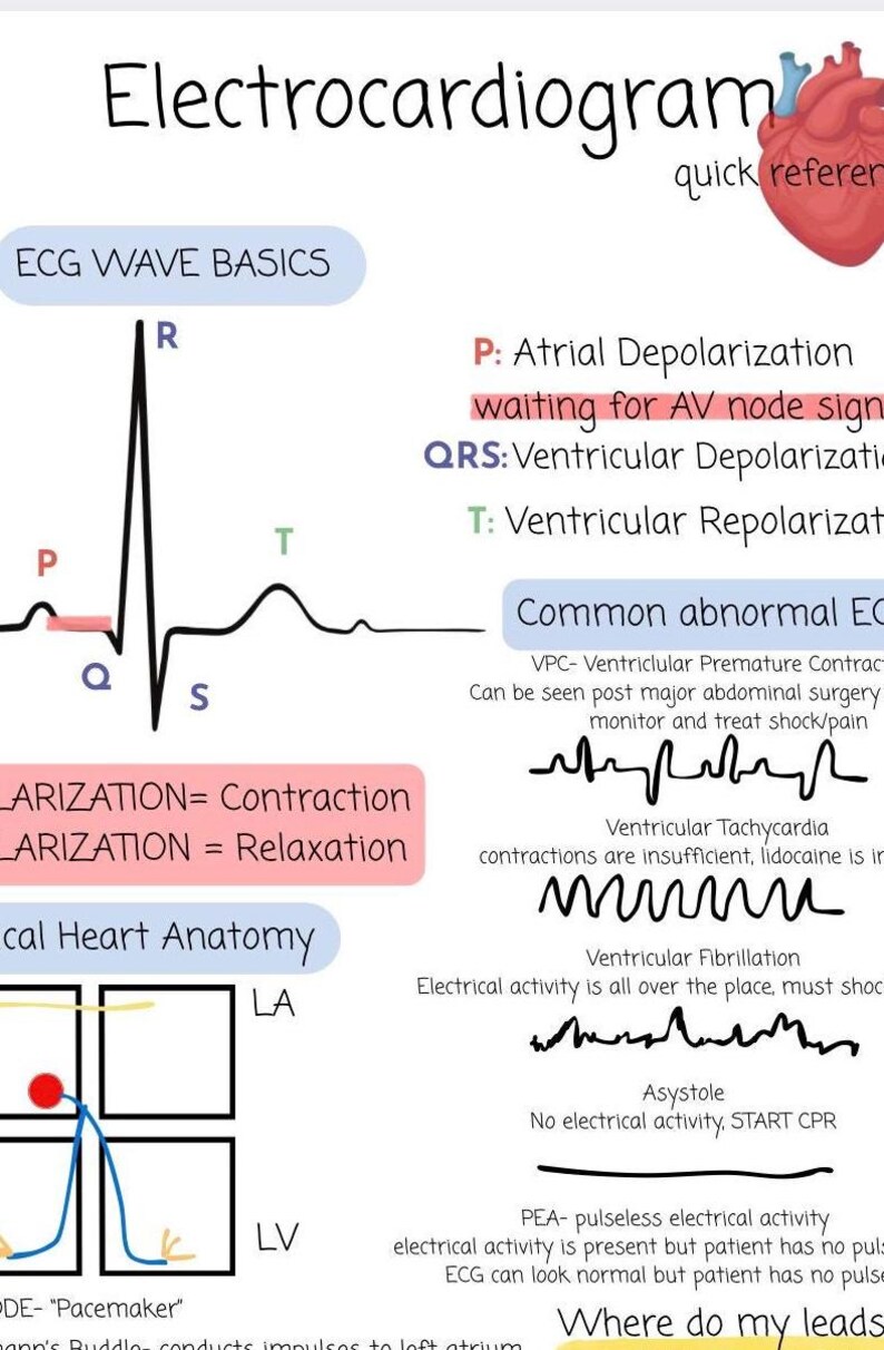 May include: An educational infographic about electrocardiograms (ECG). The image features an ECG wave diagram with labels for P, QRS, and T waves, along with explanations of common ECG abnormalities and heart anatomy.