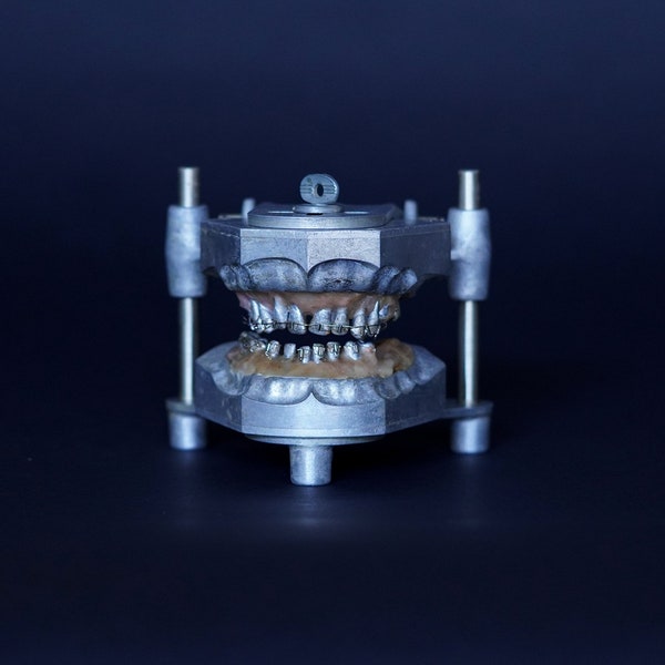 1940's Orthodontic Study Model Vintage Dental Device Medical Collectible