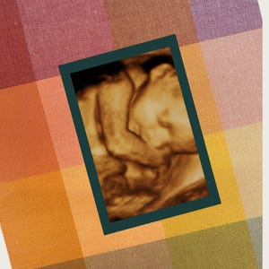 Tyginlindad ultraljudsfotomatta: 8x10 sonogram-minnessak bild 3