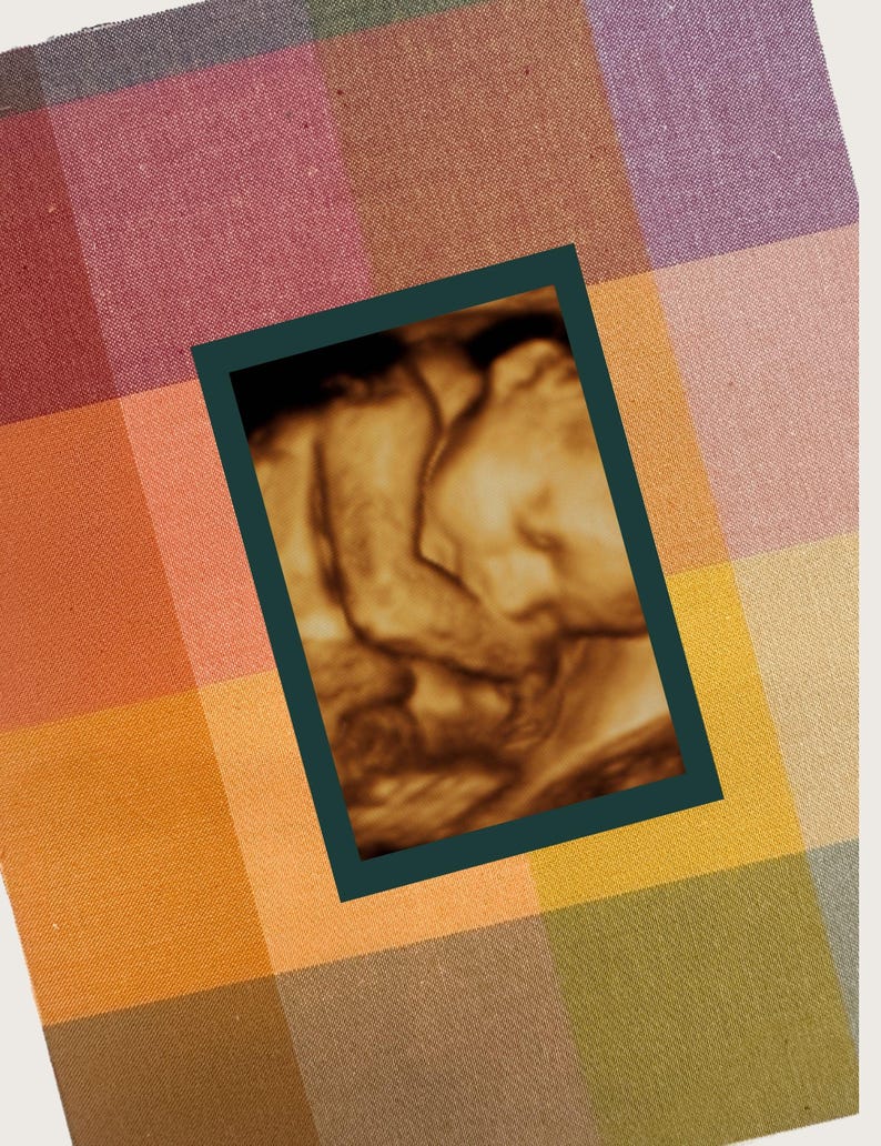 Tyginlindad ultraljudsfotomatta: 8x10 sonogram-minnessak bild 3