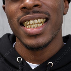 May include: Close-up of a person's mouth with gold teeth. The teeth are covered in small, sparkling gems. The person is wearing a black hoodie with silver accents.