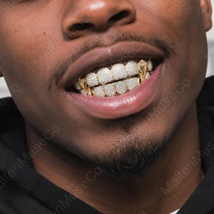 May include: A set of gold teeth grills covering the upper and lower teeth, featuring a dense pavé setting of small, clear, reflective stones across the surface, with pointed, triangular gold accents positioned at the outer edges of the dental piece.