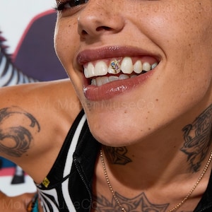 Grillz dental com estrela única banhada a ouro 14K e cravejada com zircônias | Grillz dourado brilhante que não desbota, perfeito para festas, rap e streetwear.