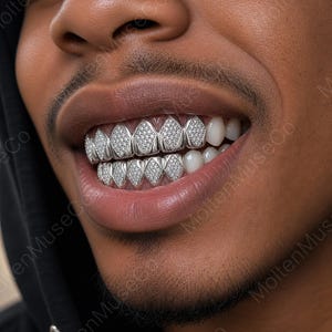 May include: Close-up of a person's mouth with silver diamond-studded grillz. The grillz are custom-fitted to the teeth and feature a pattern of diamonds. The person is smiling, showing off the grillz.