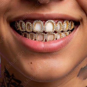 Può includere: Primo piano di un sorriso, che mostra grillz dorati. I grillz presentano una montatura dorata con pietre trasparenti e scintillanti attorno a ogni dente. I denti sono bianchi.