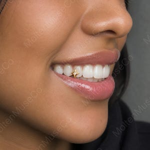 Peut inclure: Un bijou dentaire en or en forme d'étoile à quatre branches avec une petite pierre centrale ronde et transparente. Le bijou est fixé sur la surface d'une dent supérieure, positionné entre l'incisive centrale et l'incisive latérale.
