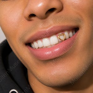 Puede incluir: Una joya dental en forma de corazón de color dorado fijada en la superficie de un incisivo lateral superior. El pequeño adorno de corazón con marco abierto está colocado sobre el esmalte blanco liso del diente, centrado junto a la encía.