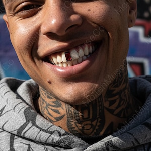 May include: Close-up of a person smiling, showcasing a red gemstone tooth. The person has a gray hoodie and a neck tattoo. The background is blurred, with hints of graffiti art.