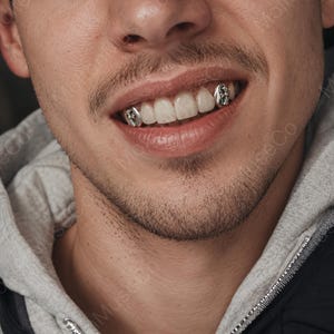 May include: Close-up of a person smiling, showcasing silver grillz on the upper teeth. The grillz feature a decorative design. The person is wearing a gray hooded sweatshirt.