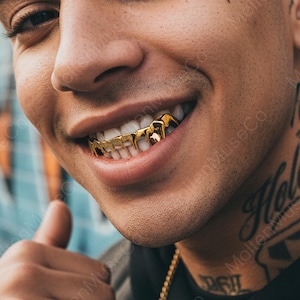 May include: Close-up of a person smiling, showcasing gold-colored teeth grillz. The grillz have a dripping design. A gold chain is visible. The person has a tattoo on their neck.