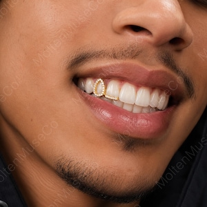 Puede incluir: Una pieza de joyería dental dorada con forma de contorno de gota, incrustada con pequeñas piedras transparentes. El accesorio se ajusta sobre un solo diente superior, presentando un marco metálico delicado que sigue el contorno del diente.