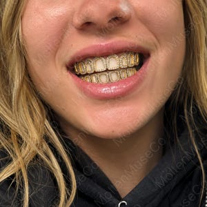 May include: A set of gold-toned dental grills covering both the upper and lower teeth. Each individual tooth section features a metallic gold border encrusted with small, clear, sparkling stones surrounding a smooth, solid, off-white centre panel.