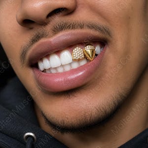 Può includere: Primo piano di una persona che sorride, mostrando grillz d'oro. Un grill è ricoperto di piccole pietre scintillanti, l'altro ha un design triangolare con una singola pietra grande. I grillz sono di colore oro brillante.