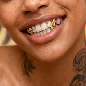 May include: Close-up of a smiling person's mouth with gold teeth. The gold teeth are visible against the white teeth. The person's skin is a warm tone, and the lips are full and slightly parted.