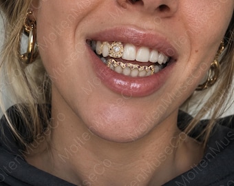 May include: A gold tooth grill set featuring a single square-shaped gold cap with a central clear stone on an upper tooth and a scalloped gold wire grill with small pink stones along the lower teeth, worn on the teeth of a smiling individual.