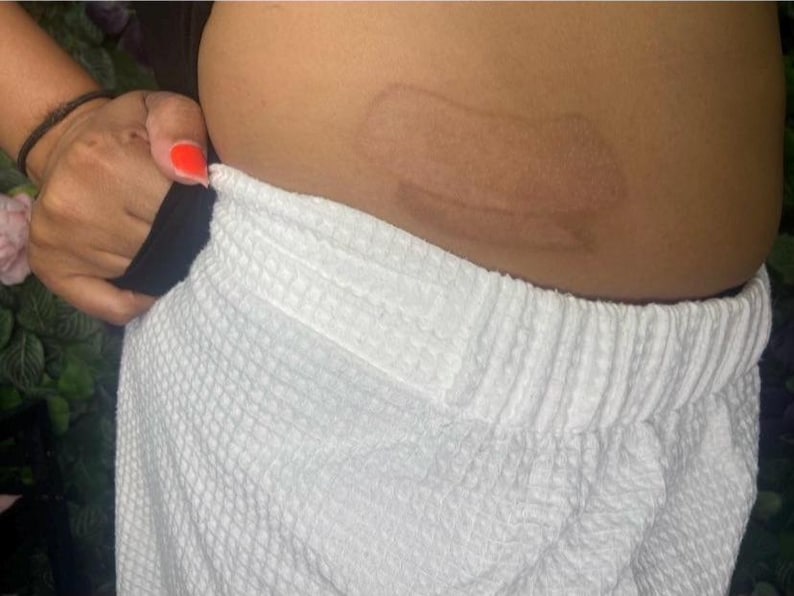 May include: Close-up of a white textured fabric garment with an elastic waistband. A hand with an orange painted fingernail is holding the garment. The skin has a brown mark.