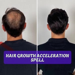Hair Growth Acceleration Spell – Grow Longer, Thicker, Beautiful Hair Fast
