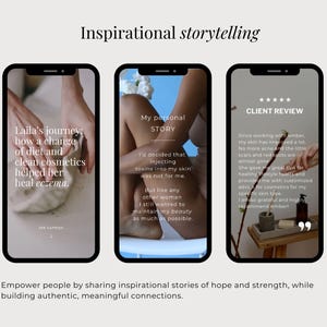 Op de afbeelding: Drie smartphoneschermen met social media content. De eerste toont tekst over Laila's reis met eczeem. De tweede bevat een persoonlijk verhaal over huidverzorging. De derde toont een klantbeoordeling met vijf sterren en tekst over huidverbetering.