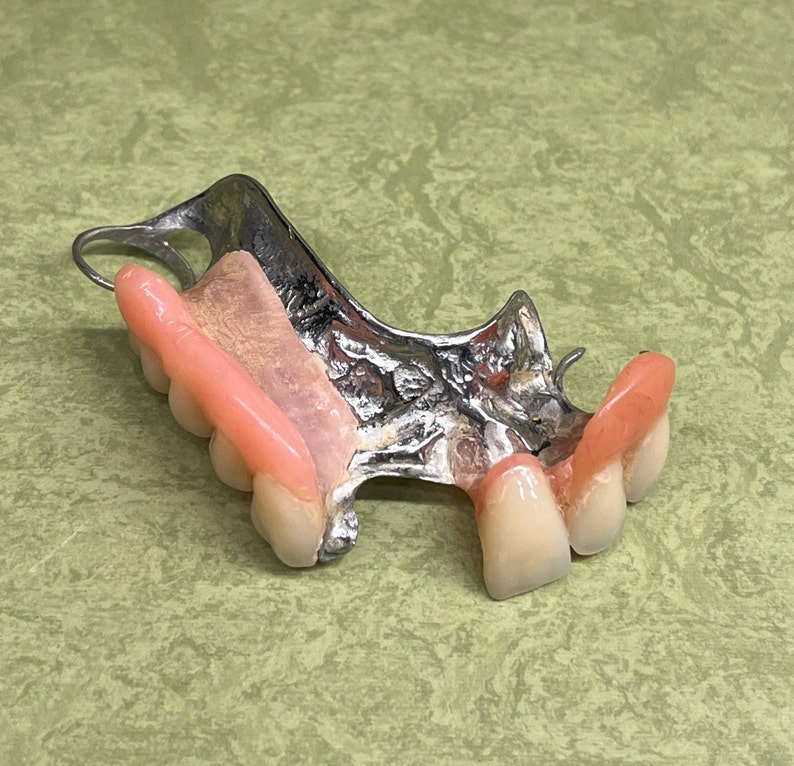 Vintage False Teeth Partial Dentures Curiosity Oddity Tooth Etsy