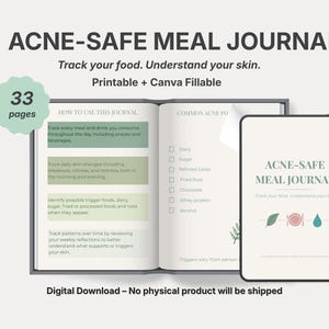 May include: An open journal and a tablet display the text "ACNE-SAFE MEAL JOURNAL". The journal's pages list instructions and common acne triggers. The tablet shows the journal's title and a graphic. The image includes the text "Track your food. Understand your skin."