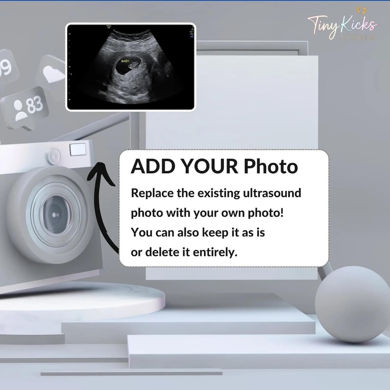May include: A digital mockup featuring a camera, social media icons, and a white frame with the text "ADD YOUR Photo". The frame includes an ultrasound image. The text encourages users to replace the photo.