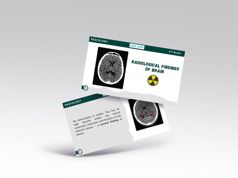 Brain Radiotherapy Card Radiology Flashcards | Medical Student Study, USMLE Prep (digital ...