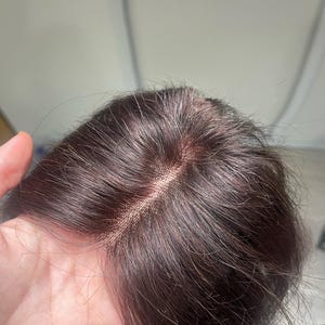 Black thin Lace Hair Topper 3.5x4inch, 11 inch Human Hair topper with clip , Face-Framing Fringe, wig for women , thin hair