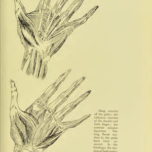 May include: Anatomy illustration of the palmar aspect of the hand, showing muscles and tendons. The image is a detailed black and white drawing, with labels and text describing the anatomical features. Plate III - Muscles of the Palmar Aspect.