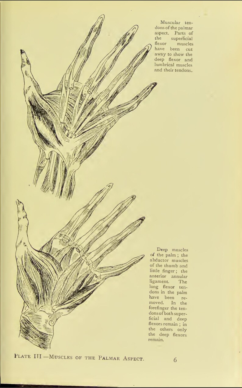 May include: Anatomy illustration of the palmar aspect of the hand, showing muscles and tendons. The image is a detailed black and white drawing, with labels and text describing the anatomical features. Plate III - Muscles of the Palmar Aspect.