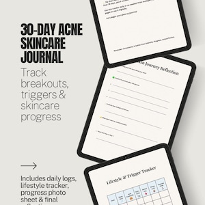 Acne Skincare and Treatment Tracker Printable Journal 30 Day Skincare Log Digital Download