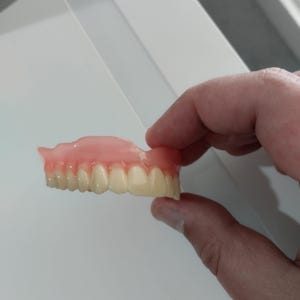 Teeth upper