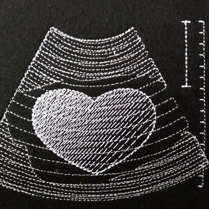 Pode incluir: Uma imagem bordada em preto e branco de um ultrassom com um coração no centro. A imagem está sobre um fundo preto.