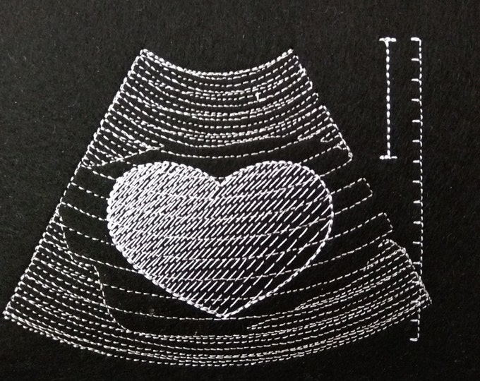LOVE Ultrasound Tech pocket - machine embroidery applique design In-the-Hoop project INSTANT DOWNLOAD