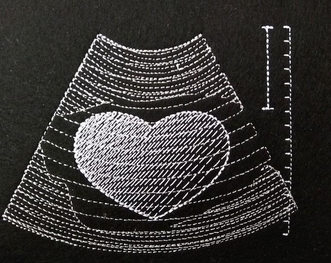 LOVE Ultrasound Tech pocket - machine embroidery applique design In-the-Hoop project INSTANT DOWNLOAD