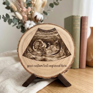 May include: A circular wood slice plaque featuring a laser-engraved ultrasound image of a fetus in the center. Below the ultrasound, the text "your custom text engraved here" is etched into the wood. The plaque rests on a dark wooden stand.